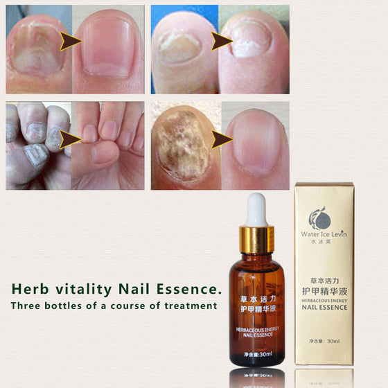 Skin Care Herbal Nail Repair